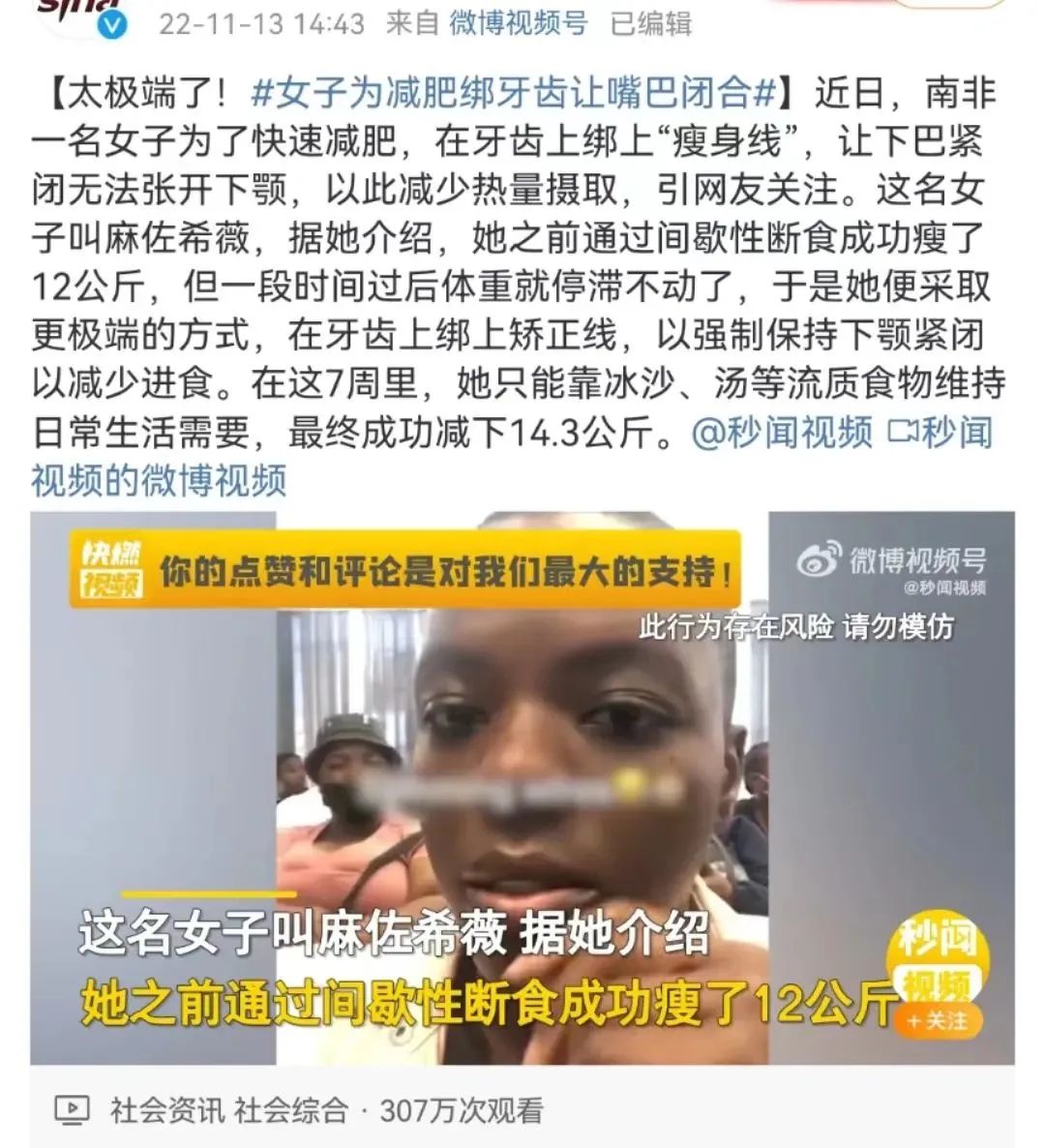女子绑牙“绝食”49天，瘦身28斤走红网络：减肥的底层逻辑是什么？-绑牙齿的好处与坏处