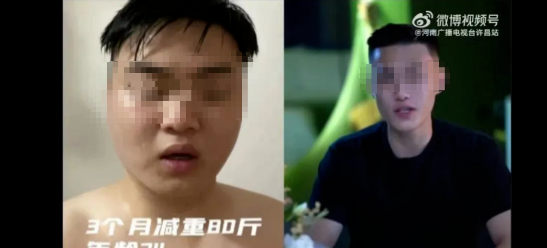 女子绑牙“绝食”49天，瘦身28斤走红网络：减肥的底层逻辑是什么？-绑牙齿的好处与坏处