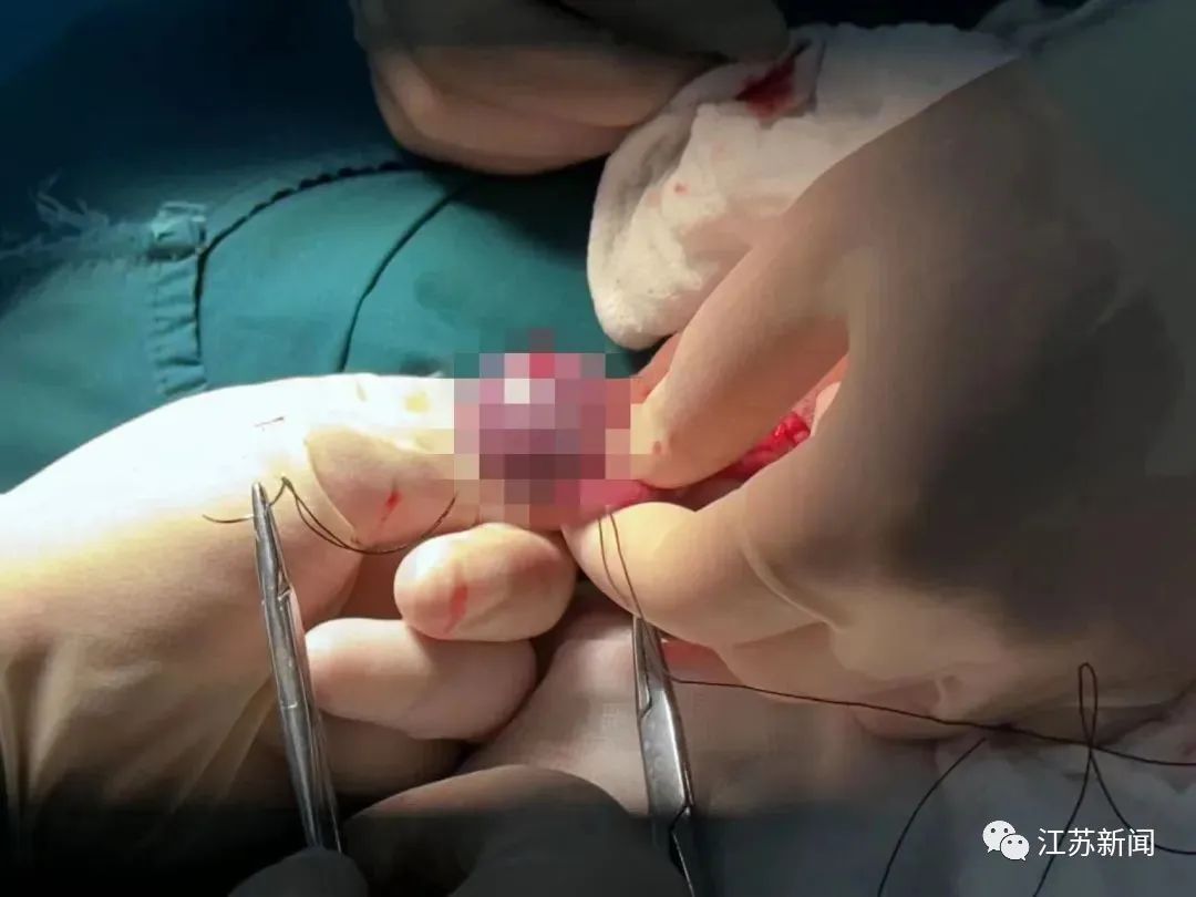 13岁男孩 蛋蛋 扭转1080 注意 这种 蛋疼 专盯年轻人 睾丸 睾丸扭转 蛋蛋 新浪新闻