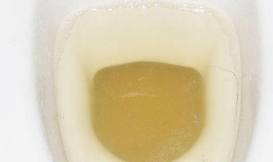 男人早起第一泡尿,反映了肾脏的好坏,这4点你符合标准了吗?__财经头条