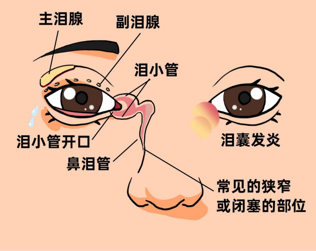 泪眼开渠迎新光!郴州市眼耳鼻喉医院眼科开展泪囊炎新技术
