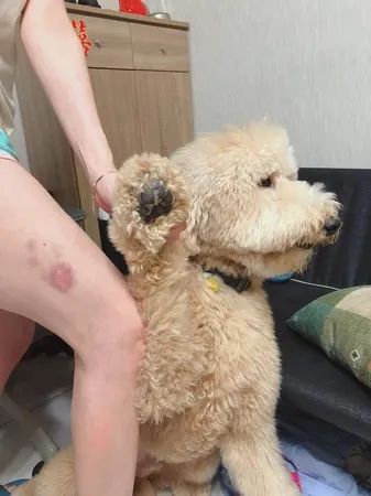 狗狗误伤主人后狗狗拒不承认，直到铲屎官露出淤青形状