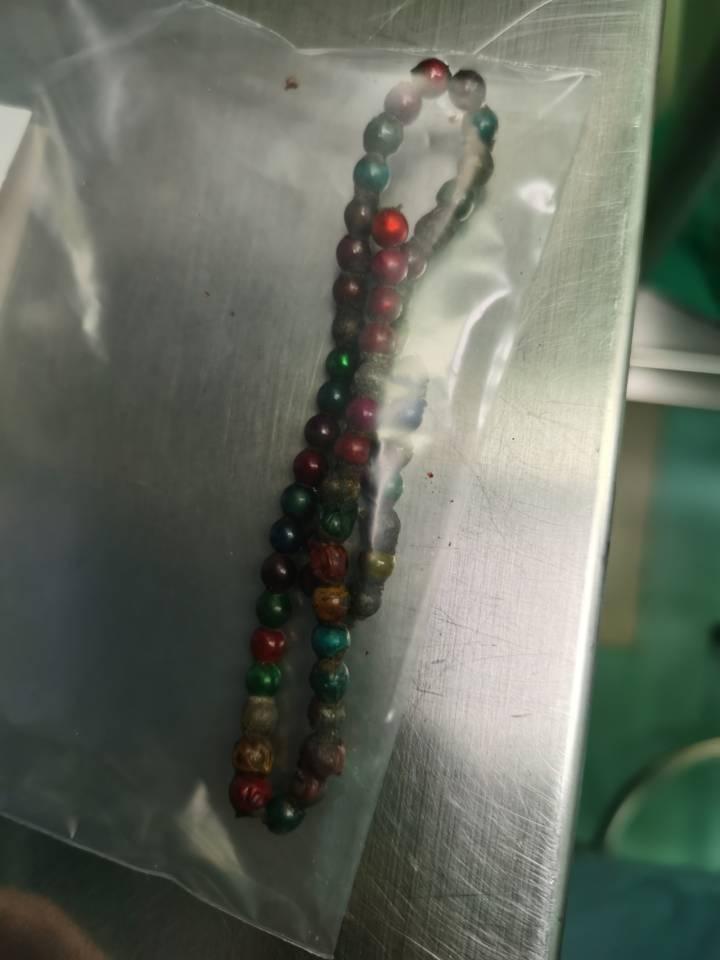 女童误食61颗磁力珠导致14处肠穿孔，医生呼吁家长不要买这种玩具！休闲区蓝鸢梦想 - Www.slyday.coM