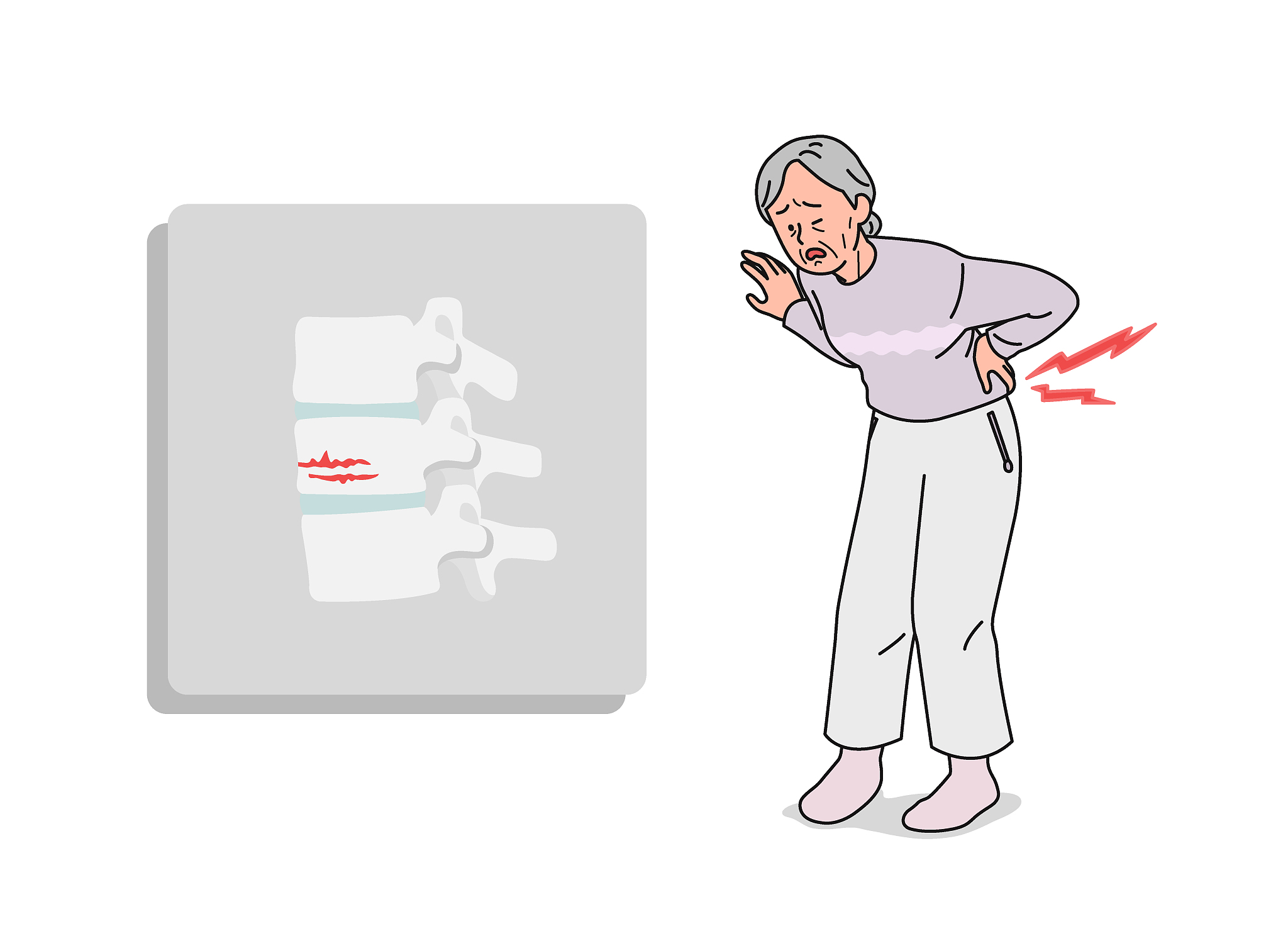 老年人腰椎骨折怎么治既快又安全?|手术|骨折|骨头_新浪新闻