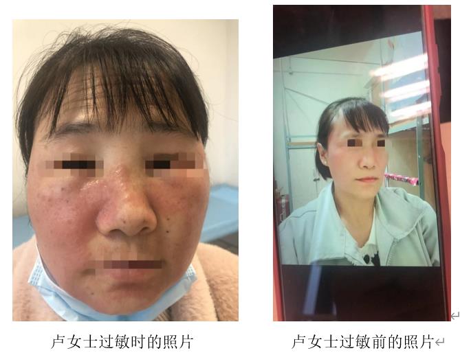 祛斑霜效果大揭秘 如何选择合适美白产品