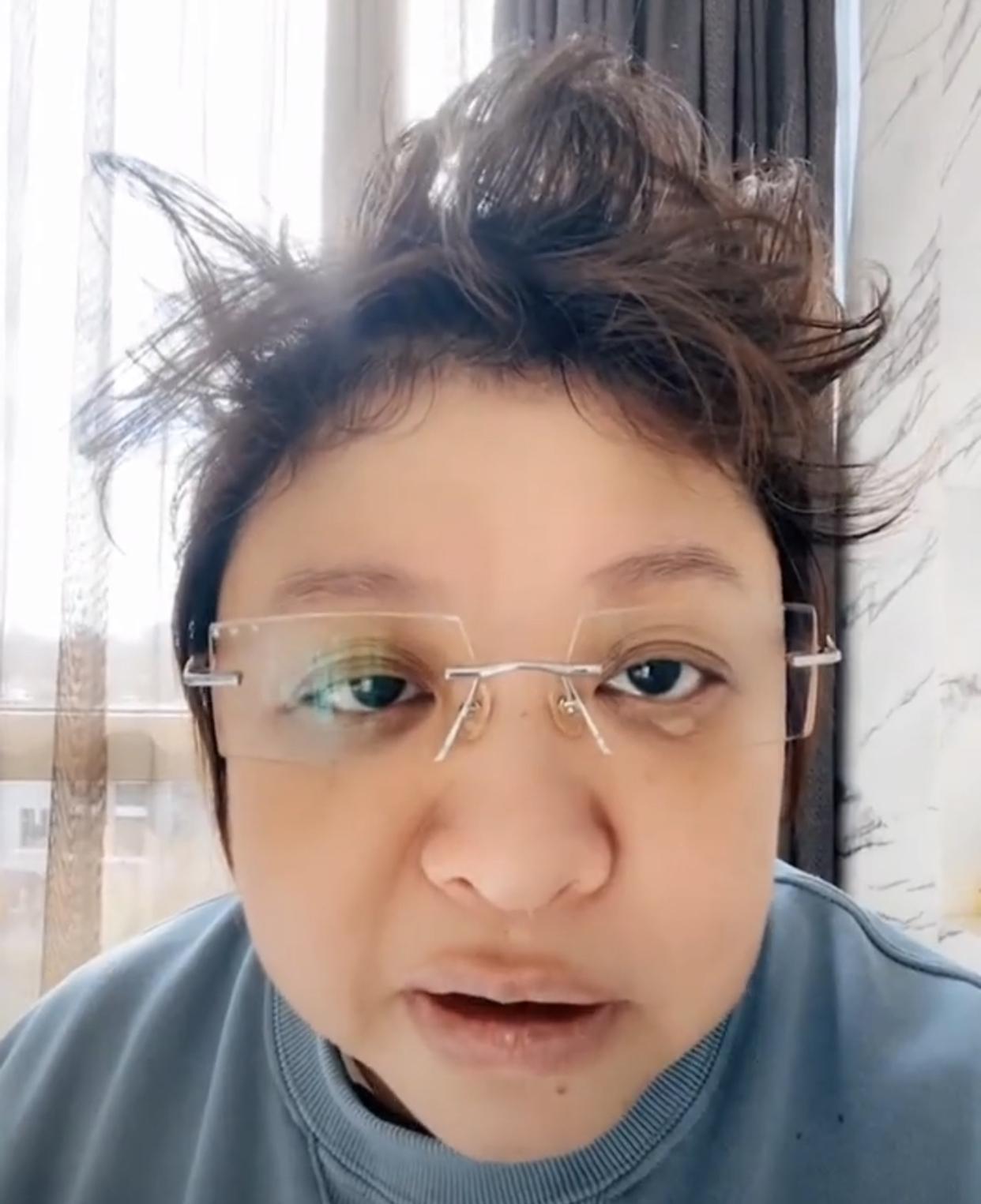 韩红确诊新冠形象大变,头发杂乱似鸡窝,身形消瘦嗓音受损变化大|新冠