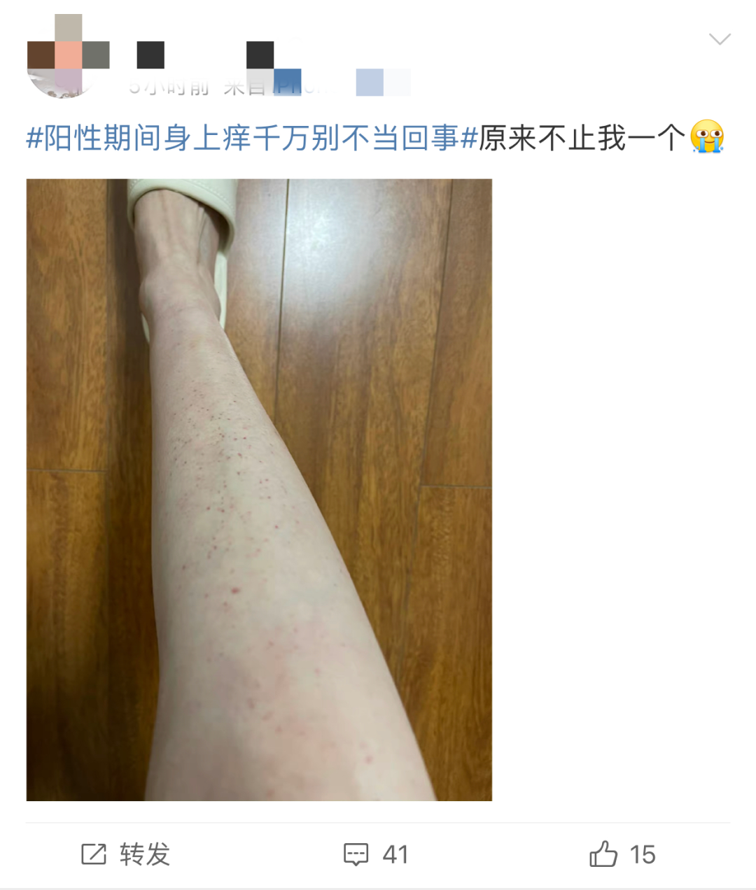 警惕 阳性期间皮肤痒 千万别不当回事 过敏 感染 新冠肺炎 新浪新闻