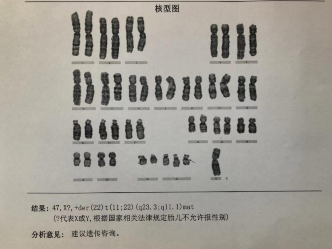 全球罕见！开封今天发现一例！