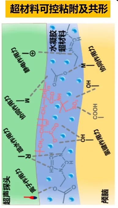 专访浙江大学郑音飞:突破“禁区”,给大脑做B超|浙江大学|医学_新浪新闻