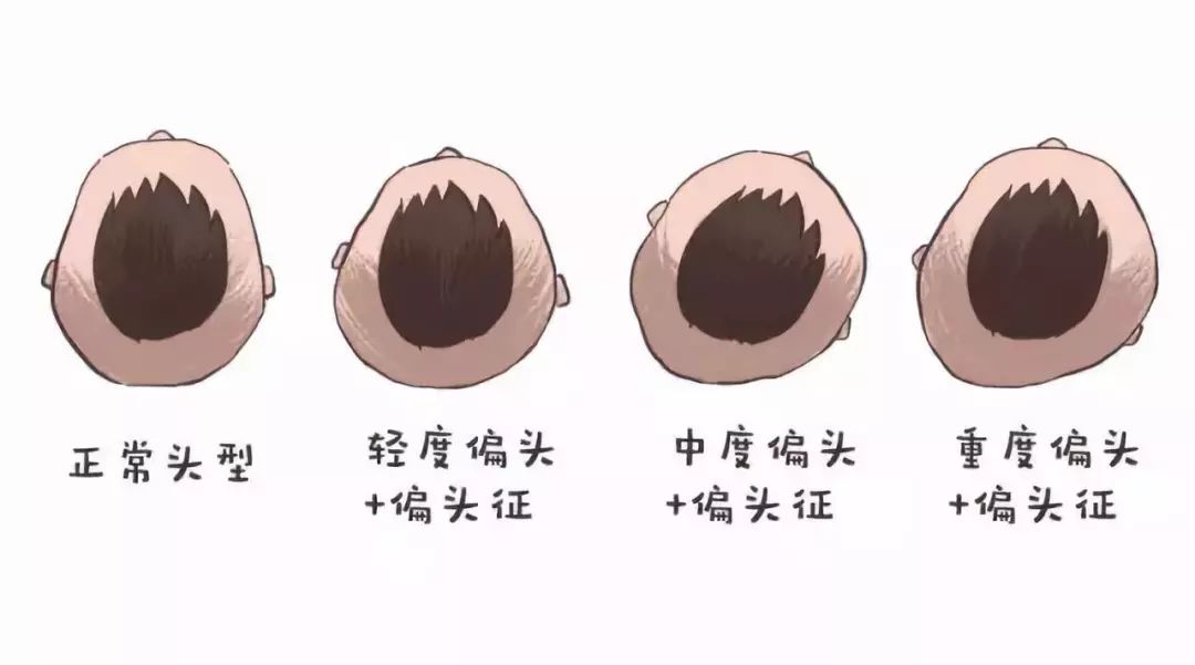 圆头pk扁头,睡头型也有黄金期,再不重视就晚了!__财经头条