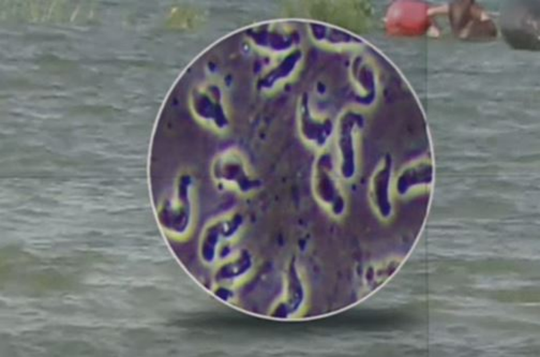 韩国现首例感染"食脑变形虫"病例,患者出现症状10余日后死亡|韩国