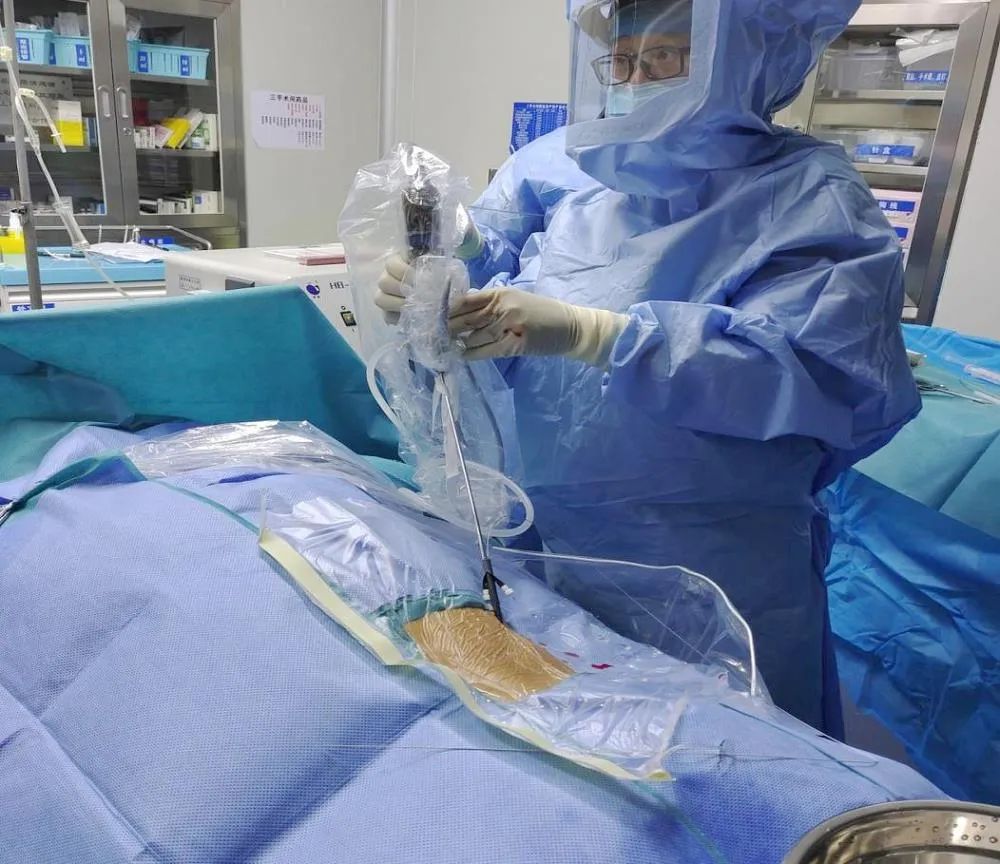 综合外科为艾滋病患者实施"经皮肾镜气压弹道碎石术"治疗