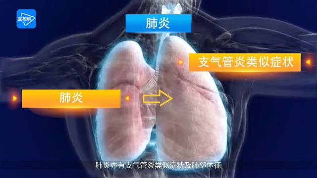 急性气管-支气管炎与肺炎相鉴别更多医学课程……|肺炎|支气管炎_新浪新闻