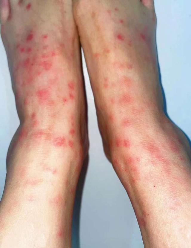 受访单位供图作为医院疫情防控的前哨阵地,发热门诊的工作是疫情防控