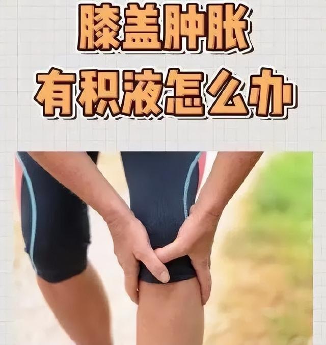 膝关节积液,咱老百姓有三个土方法,成本才几块钱|生姜_新浪新闻