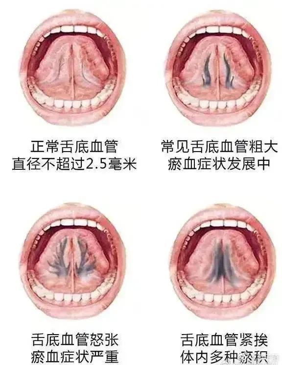 舌下图片大全图解图片