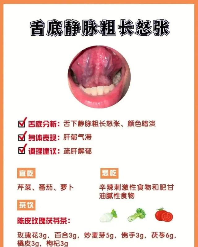 照镜子,看看舌下有青筋吗?|青筋|静脉|舌头_新浪新闻