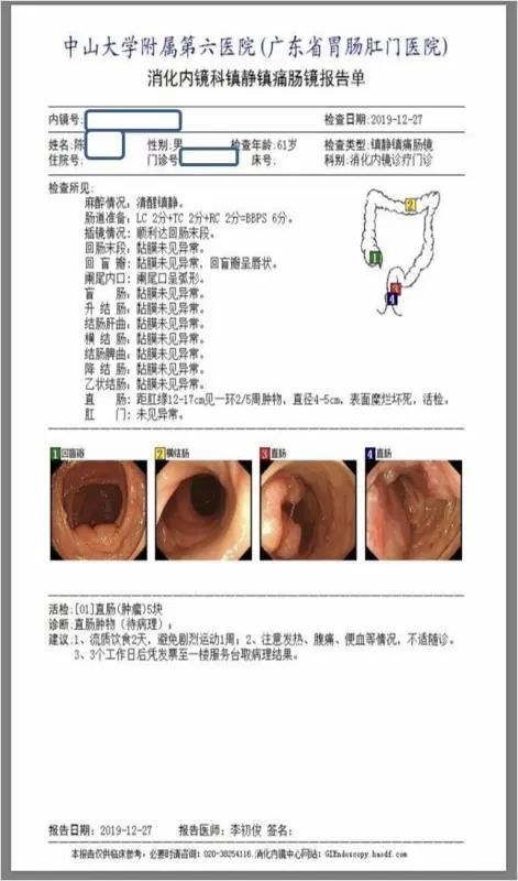 从肠镜检查所见,基本可以确定,直肠息肉已经癌变为直肠癌,而且已经不