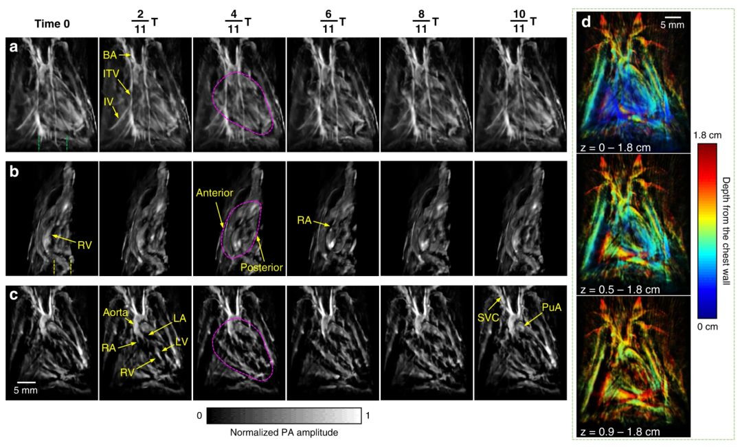 图丨通过 3D-PACT 获得的大鼠心脏结构图像（来源：Light: Science & Applications）