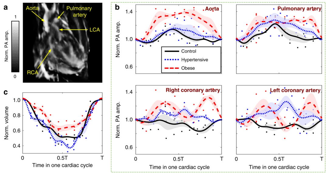 图丨健康、高血压和肥胖大鼠心血管血流动力学比较（来源：Light: Science & Applications）