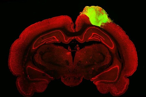 小鼠大脑（红色）与植入的人脑类器官（绿色）。图片来源：英国《新科学家》杂志网站