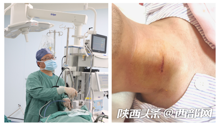 手术中的卫建民医生(左)缝合后的患者颈部伤口(右)