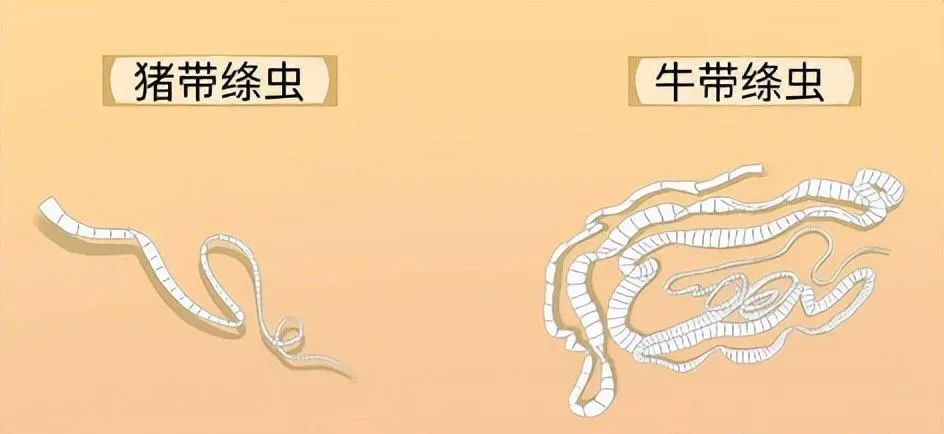 这些白点就是绦虫的幼虫长着小白点的牛肉,猪肉不知道你有没有买到过