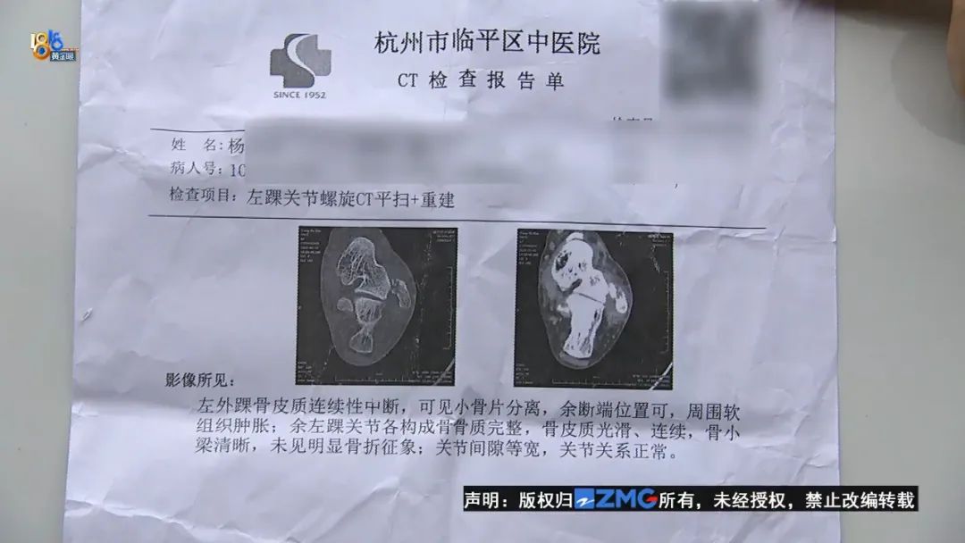 他拿出了一张杭州市临平区中医院的ct报告单,诊断结论为,左外踝骨折