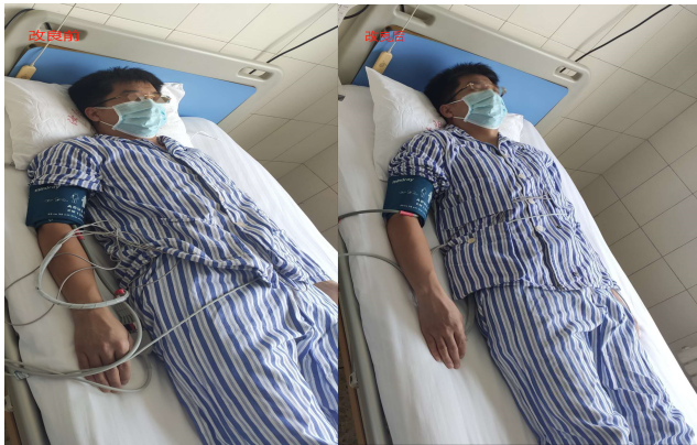 护士改良式病号服，让导联线不再凌乱！