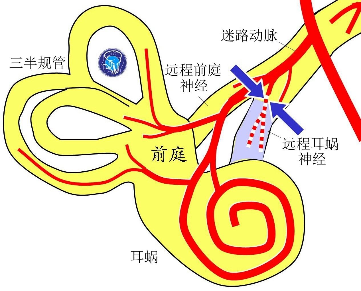 晕眩耳鸣专栏远程耳蜗神经病变综合症
