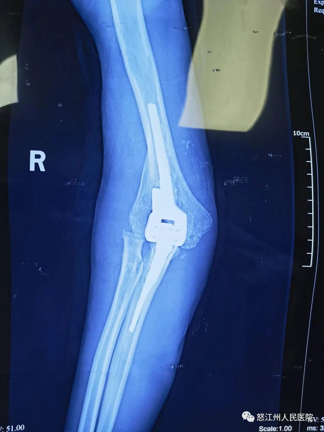 近日消息透露显示:大鲁店站街都去哪里了?深度解析背后的迁移原因与去向预测