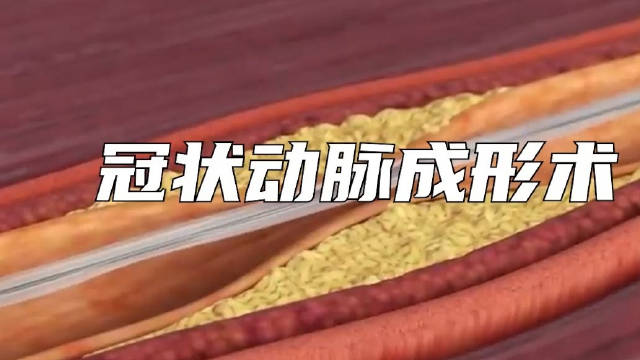 西直门百度seo优化