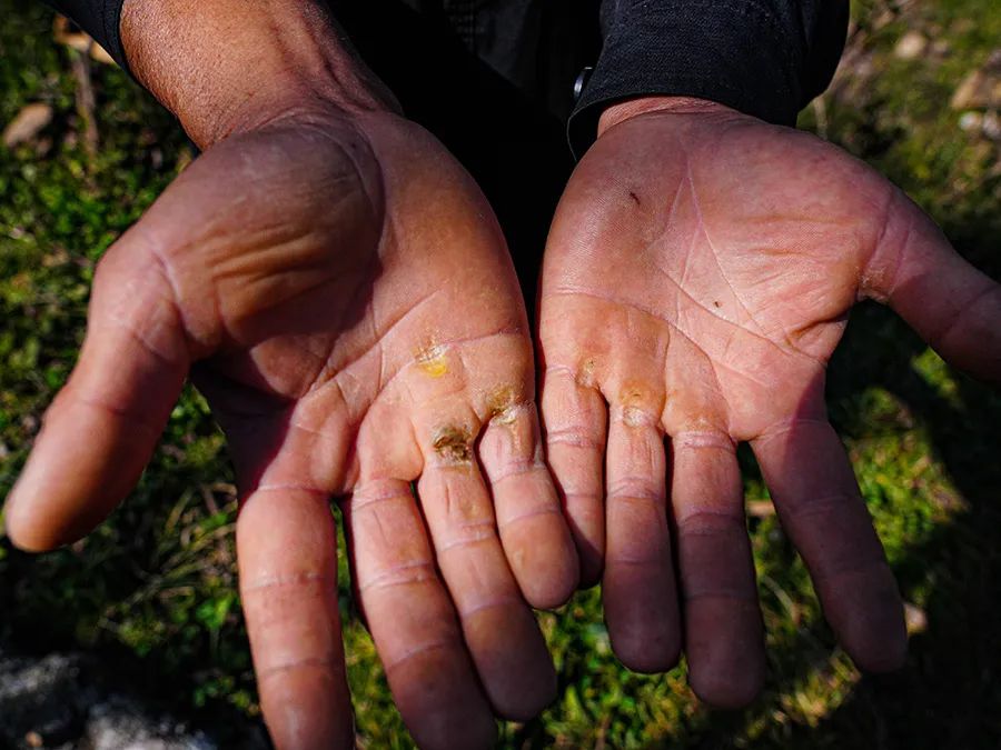 民警手上的老茧(资料图)