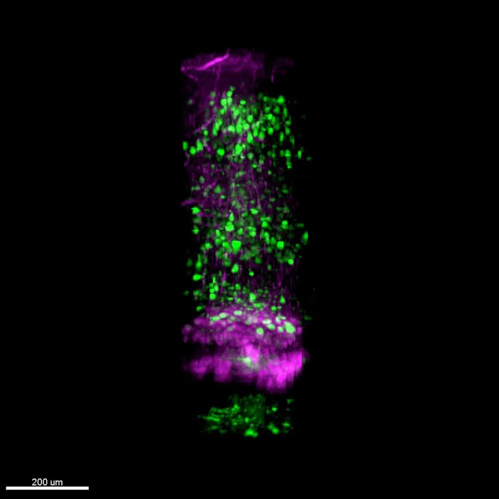 图为使用微型化三光子显微镜对小鼠大脑皮层和海马CA1亚区结构成像。研究团队供图
