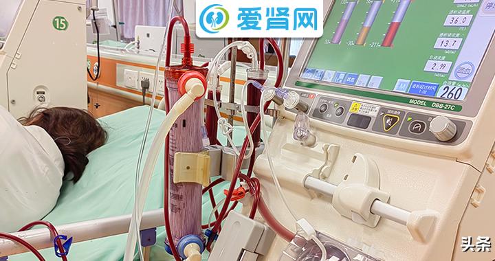 【透析器材No.2】带你轻松了解五种透析方式,选好方式透析更长久|肾病|血液透析|血透|毒素|分子_新浪新闻