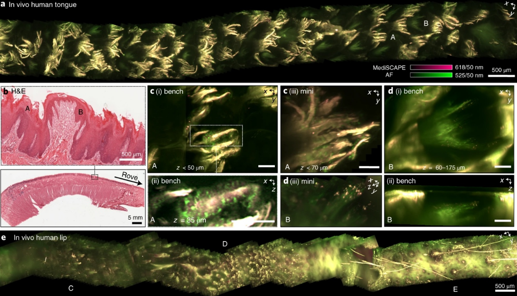 图丨人体口腔的活体成像（来源：Nature Biomedical Engineering）