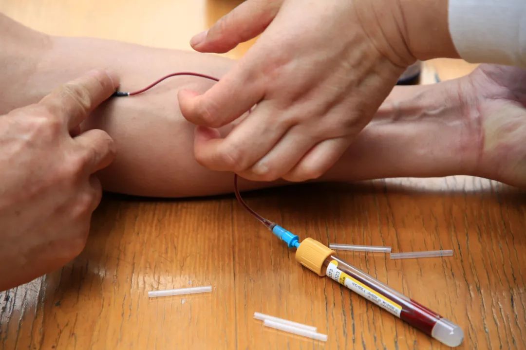 血沉即红细胞沉降率检查还可以辅助诊断感染性疾病,风湿免疫性疾病