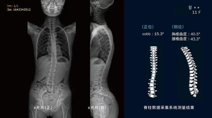 老年人无明确病史、久坐后下肢肌张力升高且活动缓解，需做神经系统检查吗？