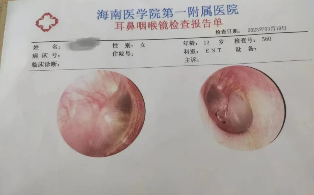 海南医学院第一附属医院开具的耳鼻咽喉镜检查报告单。受访者供图