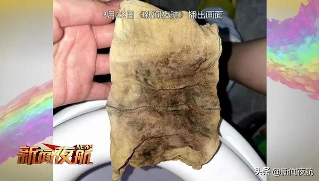 哈尔滨一女子产后身体出现异常，检查后发现大块纱布滞留体内！医院：疏忽