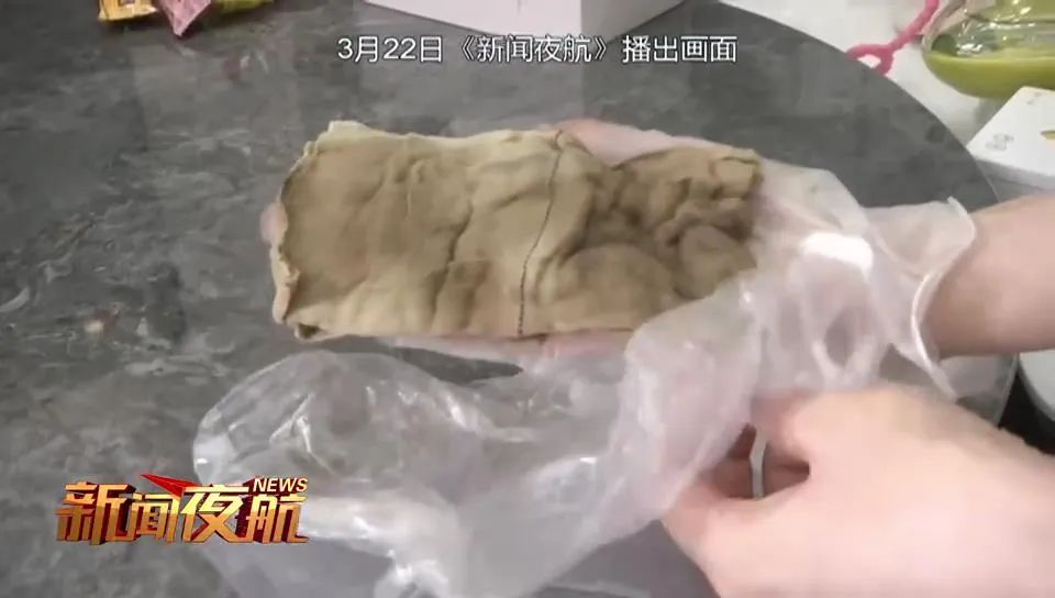 哈尔滨一女子产后身体出现异常，检查后发现这东西滞留体内！医院：疏忽休闲区蓝鸢梦想 - Www.slyday.coM