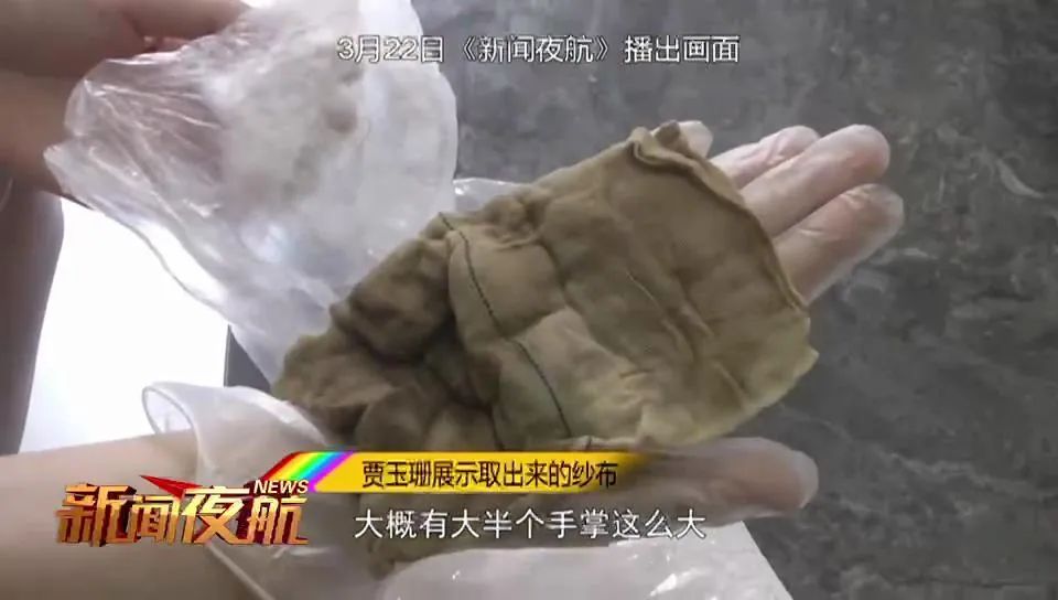 哈尔滨一女子产后身体出现异常，检查后发现这东西滞留体内！医院：疏忽休闲区蓝鸢梦想 - Www.slyday.coM