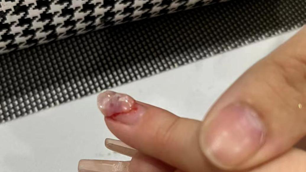 深圳一女子做美甲受伤出血索赔误工费遭拒,店家称建议走法律途径