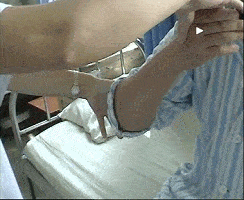 帕金森病|多巴胺_新浪新闻