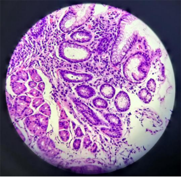 出现这样的情况就是得了胃癌?这几大情况,一定要重视!__财经头条