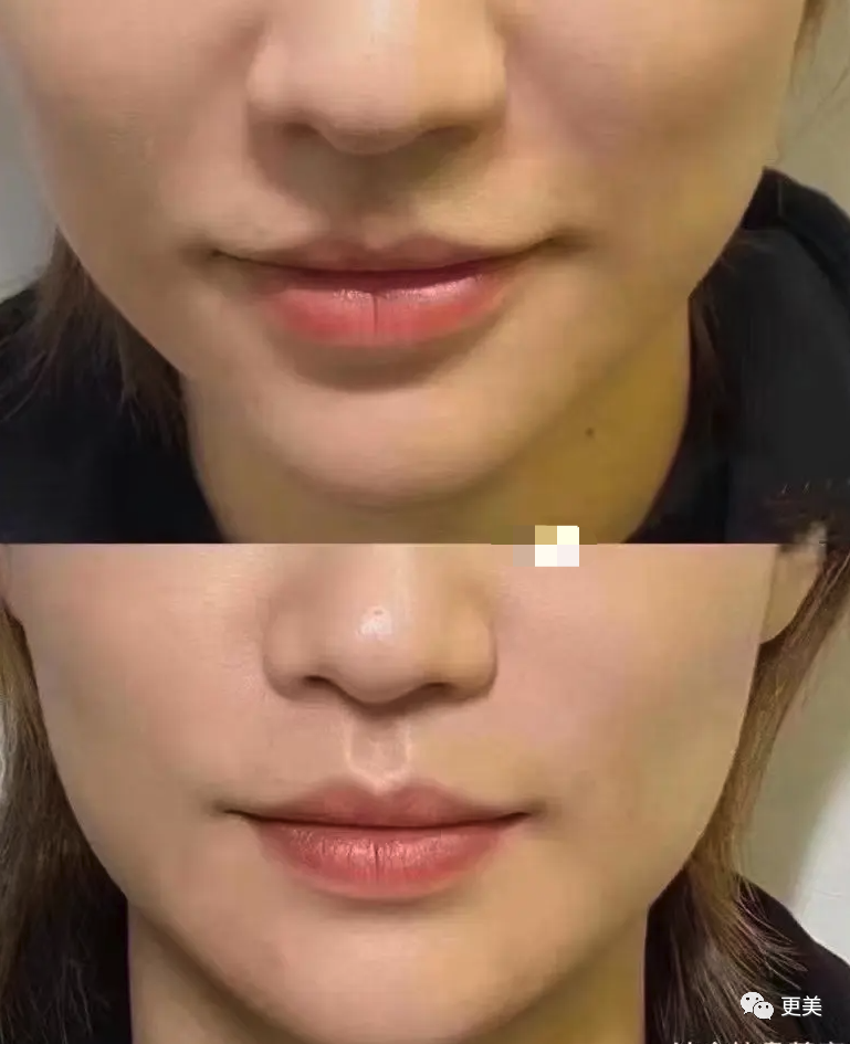 48岁贾静雯参加《浪姐》后暴瘦，却被喷贩卖体重焦虑…休闲区蓝鸢梦想 - Www.slyday.coM