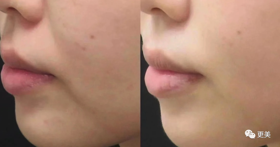 48岁贾静雯参加《浪姐》后暴瘦，却被喷贩卖体重焦虑…休闲区蓝鸢梦想 - Www.slyday.coM