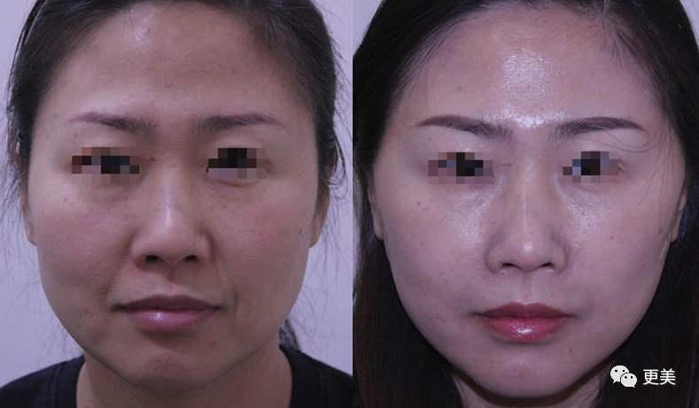 48岁贾静雯参加《浪姐》后暴瘦，却被喷贩卖体重焦虑…休闲区蓝鸢梦想 - Www.slyday.coM