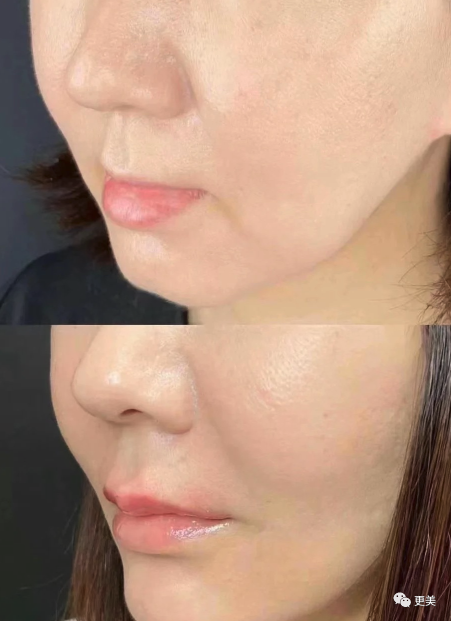 48岁贾静雯参加《浪姐》后暴瘦，却被喷贩卖体重焦虑…休闲区蓝鸢梦想 - Www.slyday.coM