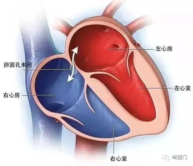 台州女子“生不如死”40多年，终于找到“元凶”！20%的成人都有，千万别忽视！